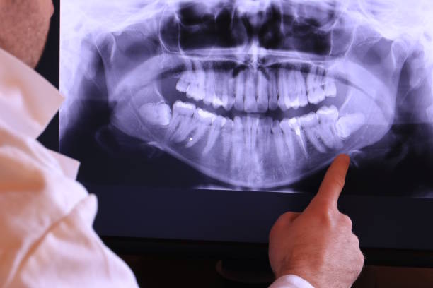 Best After-Hours Emergency Dentist in Salisbury, NC