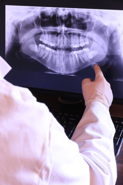 Best Emergency Treatment for Toothache in Salisbury, NC