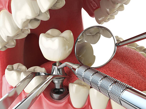 Best Walk-In Emergency Dentist in Salisbury, NC